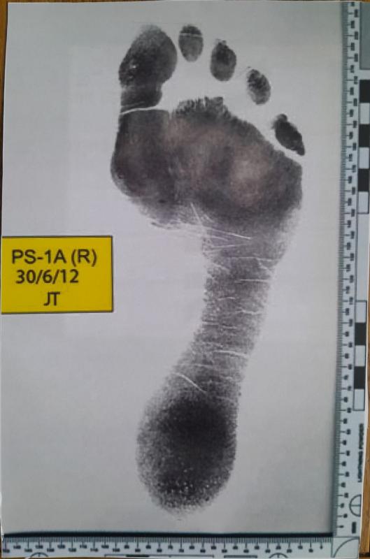 What is Forensic Podiatry Vale of Belvoir Rotary Club